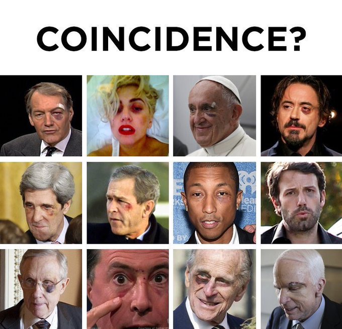 Pope and Jimmy Carter join the "BLACK EYE CLUB"